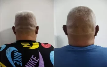 por robo en viviendas