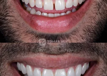 primera cita en odontología