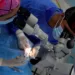 Pacientes con cataratas