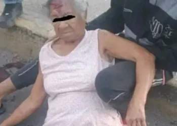 Abuelita atropellada por un motorizado