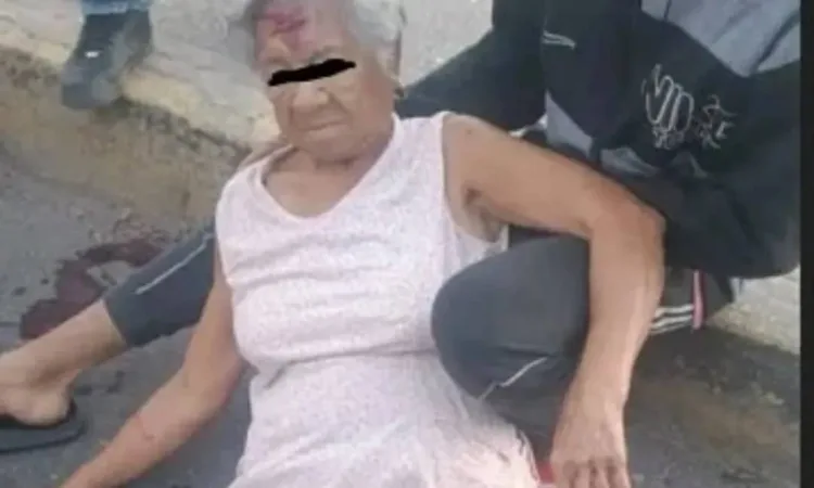 Abuelita atropellada por un motorizado