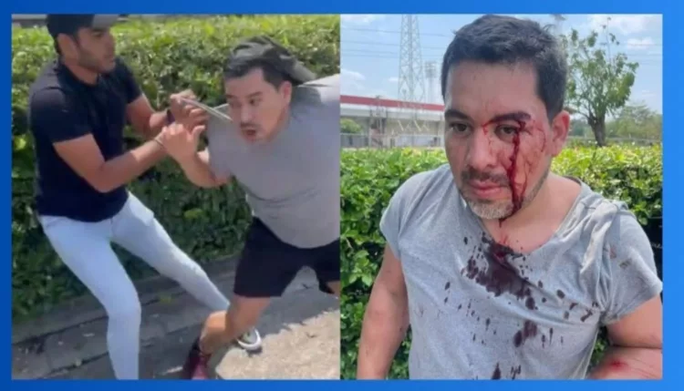 Las autoridades judiciales en Venezuela iniciaron una investigación para sancionar a los responsables de agredir a un ciudadano en el estado Portuguesa.