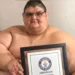 Juan Pedro Franco, el mexicano conocido por haber sido el hombre más obeso del mundo tras obtener el récord Guinness en 2017 con casi 600 kilos de peso, falleció a los 41 años en el estado de Aguascalientes, informan medios locales. Su médico tratante, José Antonio Castañeda, informó que la muerte se debió a una infección renal con complicaciones sistémicas mientras estaba hospitalizado. «En los últimos días, su estado de salud se vio comprometido a causa de una infección renal con complicaciones sistémicas, lo que derivó en su fallecimiento», señaló el doctor en un comunicado. El especialista destacó que el caso fue un proceso médico «complejo y desafiante» que ayudó a visibilizar la obesidad como una enfermedad. Su lucha contra el coronavirus y la obesidad En 2017, con 32 años y cerca de 595 kilos, Franco inició un tratamiento con Castañeda que incluyó una dieta mediterránea y dos cirugías: manga gástrica y ‘bypass’ gástrico. Esto le permitió reducir un 49 % de su peso inicial. Además, en 2020 logró superar un contagio de covid-19, pese al alto riesgo que su condición representaba. El médico expresó sus condolencias a la familia y resaltó la «perseverancia, resiliencia y honestidad» de Juan Pedro, cuya historia generó empatía y motivó a otros a enfrentar sus retos de salud.