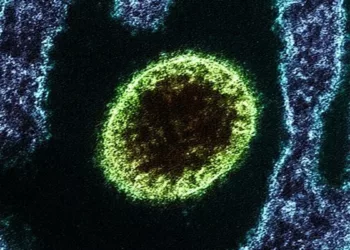 virus Nipah
