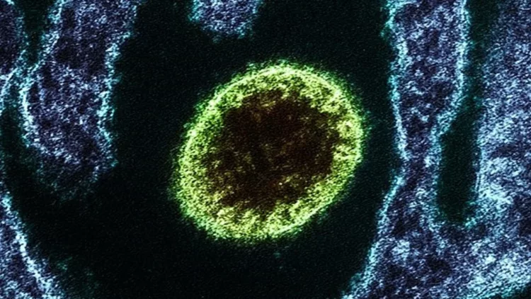 virus Nipah