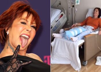 Alejandra Guzmán, de 58 años, posee prótesis de titanio en ambas caderas debido a cirugías previas.