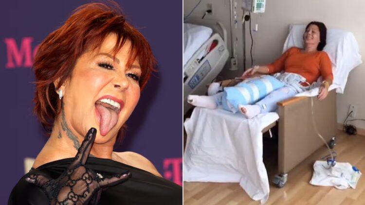 Alejandra Guzmán, de 58 años, posee prótesis de titanio en ambas caderas debido a cirugías previas.